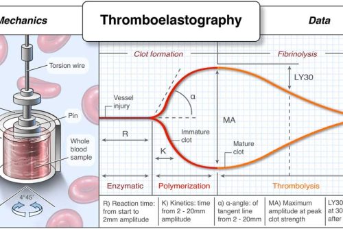 sage_thromboelstography-1000x540